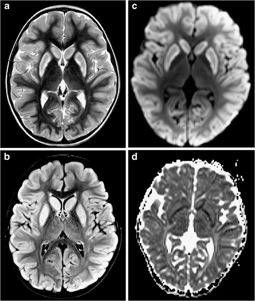 Four-panel MRI figure
